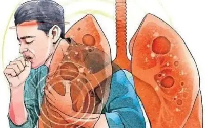 टीबी मरीजों के नाम पर 200 करोड़ का घोटाला! प्रधानमंत्री कार्यालय की रिपोर्ट में दिल्ली सरकार के अधिकारियों पर गिरी गाज