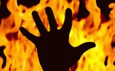 चार लोगों को ज़िंदा जलानेवाला खुद भी झुलसा