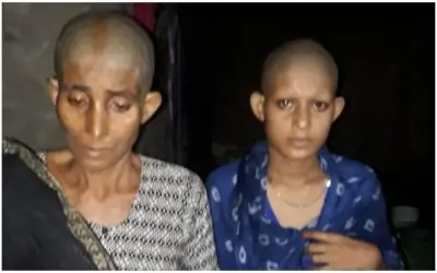 मनचलों ने मां बेटी का मुंडन कर सरेआम घुमाया