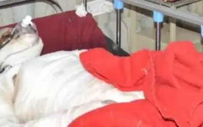 युवती ने छेड़छाड़ का विरोध किया तो उसे ज़िंदा जलाने की कोशिश