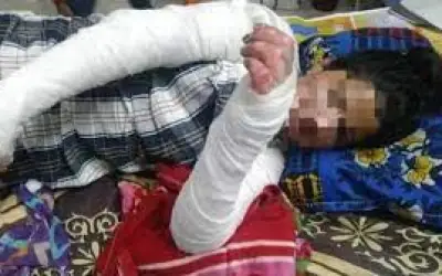 झारखंड में छात्रा को जिंदा जलाने दो आरोपी दोषी करार, जल्द सुनाई जाएगी सजा