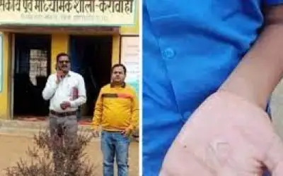 गंदगी फैलाने वाली 25 स्कूली छात्राओं के हाथों पर डाला गया खौलता तेल
