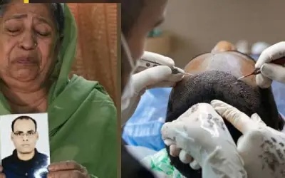 हेयर ट्रांसप्लांट सर्जरी के दौरान हुई लापरवाही ने ली युवक की जान
