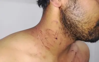 धुलिया में सरकरी  डॉक्टर  को  मरीज़  के  रिश्तेदारों  ने  बेरहमी  से  मार -पिटा 