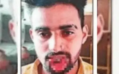 बलात्कार से बचने के लिए पीड़िता ने युवक के होंठ काट डाले